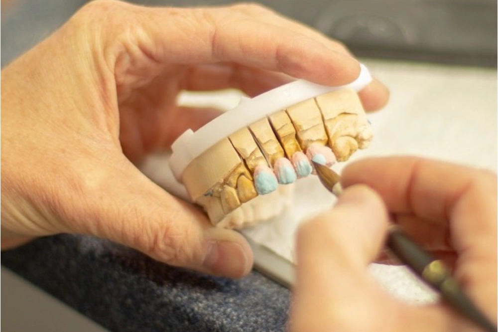 Keramikbruecke Wien Zahnersatz Dentallabor